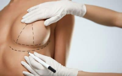 Cirugía de reducción de mamas