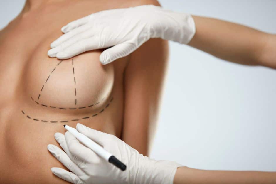 Cirugía de reducción de mamas